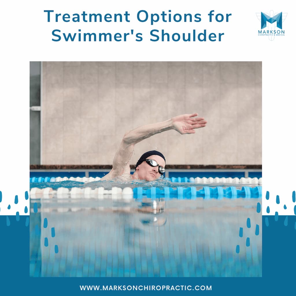 Treatment Options for Swimmer's Shoulder