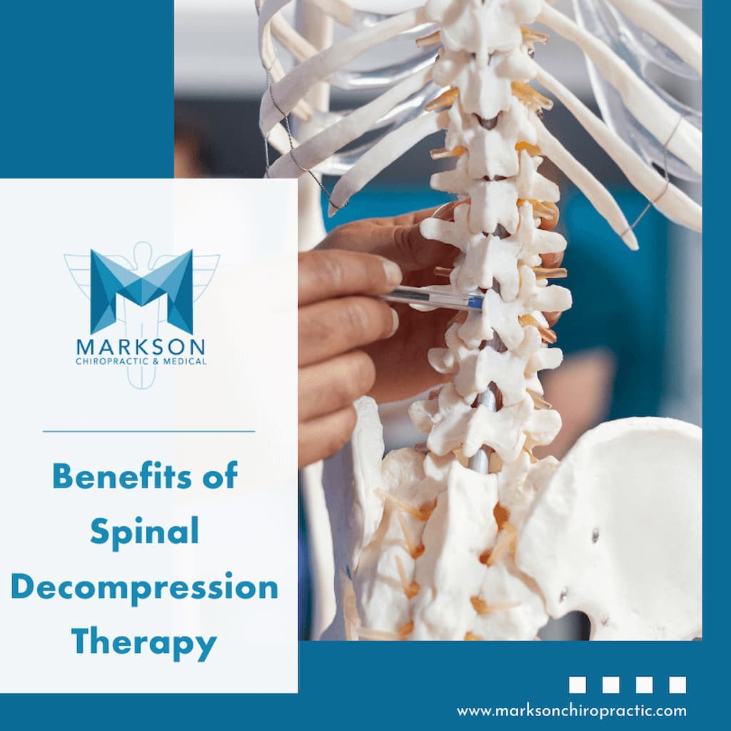 Benefits of Spinal Decompression Therapy